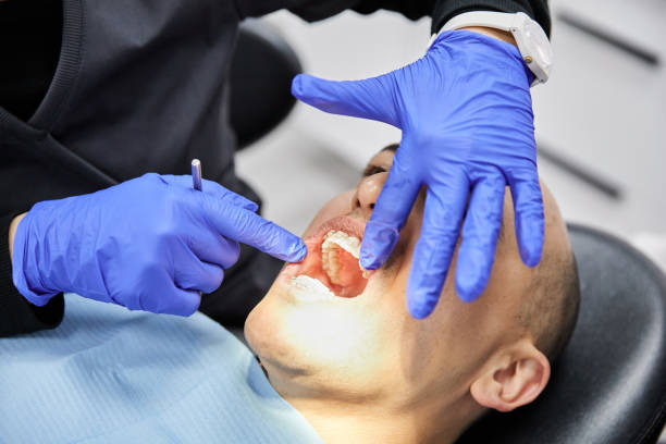 Best Knocked-Out Tooth (Avulsed Tooth) Treatment in Fox Lake Hls, IL