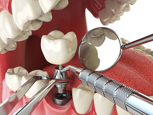 Best Walk-In Emergency Dental Services in Fox Lake Hls, IL